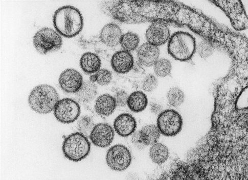 Συναγερμός στις ΗΠΑ για θανατηφόρο ιό σε πάρκο της Καλιφόρνιας