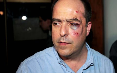 Αγριο ξύλο και τραυματισμοί στη βουλή της Βενεζουέλας