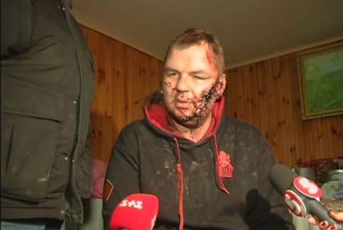 Φρικτά κακοποιημένος βρέθηκε ουκρανός διαδηλωτής