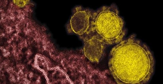Νέα κρούσματα του MERS στη Σαουδική Αραβία, συνεχίζονται οι έρευνες στην Ελλάδα