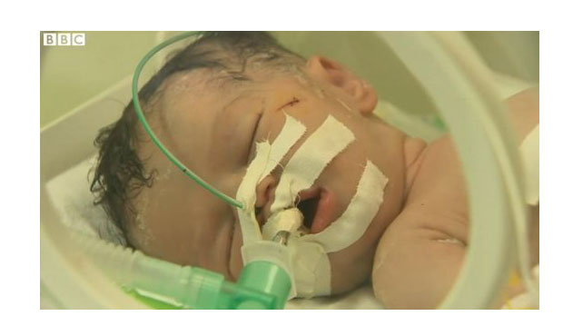 Γάζα: Γιατροί έσωσαν βρέφος κάνοντας καισαρική στη νεκρή μητέρα του