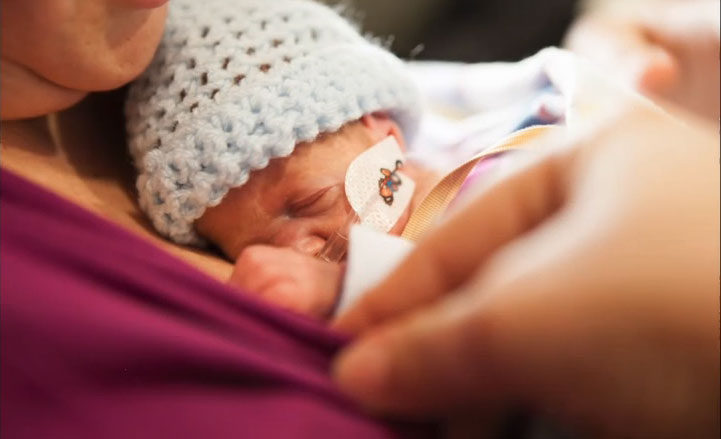 Οι πρώτες 100 ημέρες ενός μωρού γεννημένου πρόωρα