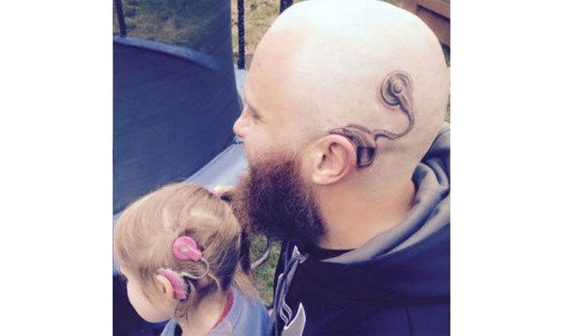 Πατέρας έκανε τατουάζ το εμφύτευμα της κόρης του στο αυτί για να τη στηρίξει